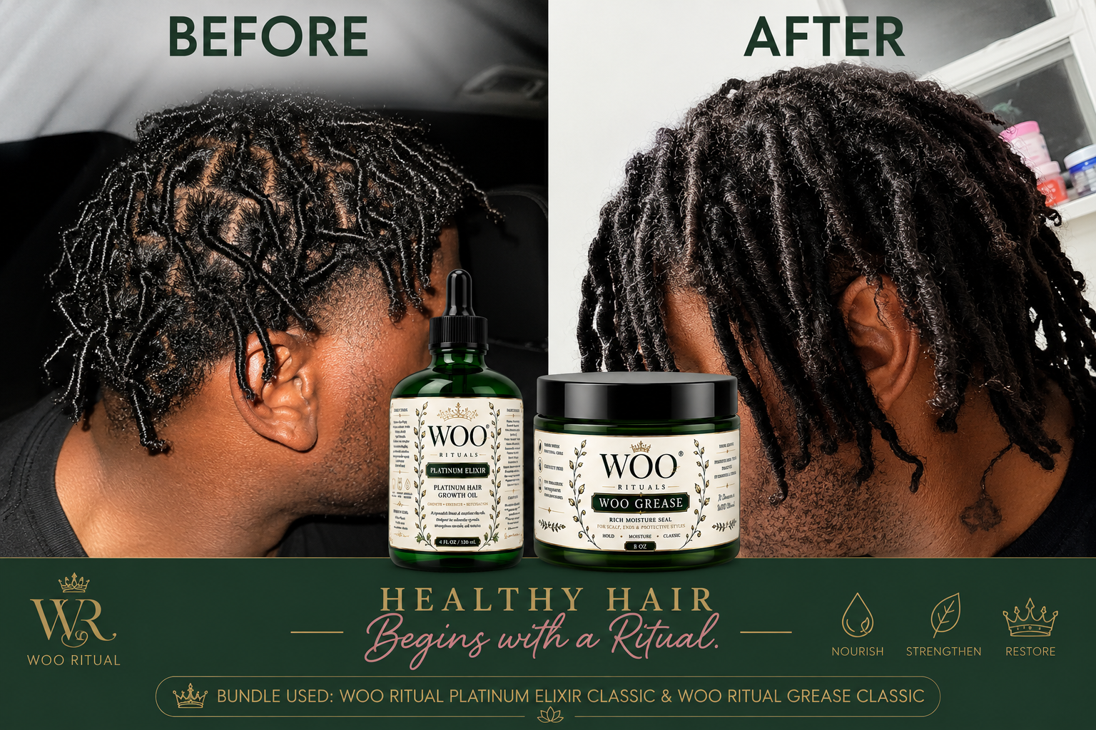 Before and after results using the WOO Ritual Platinum Bundle Classic — Platinum Elixir hair growth oil and WOO Grease rich moisture seal